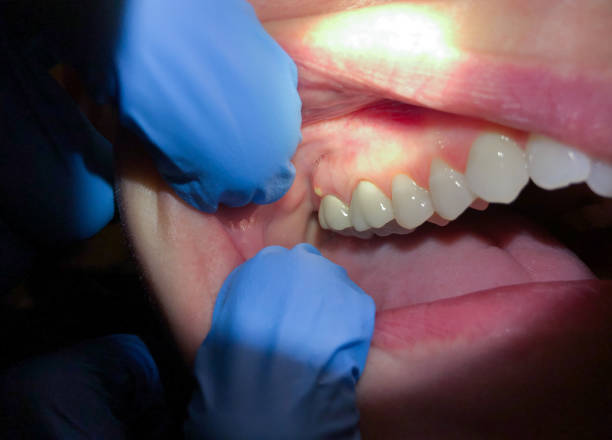 Best Pediatric Emergency Dentist in Susitna North, AK