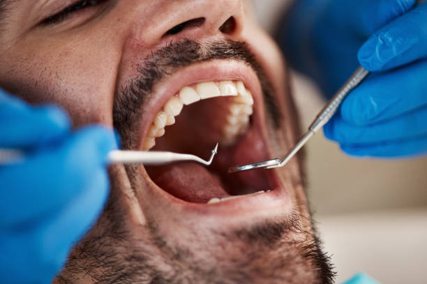 Best Urgent Dental Care for Toothache in Susitna North, AK
