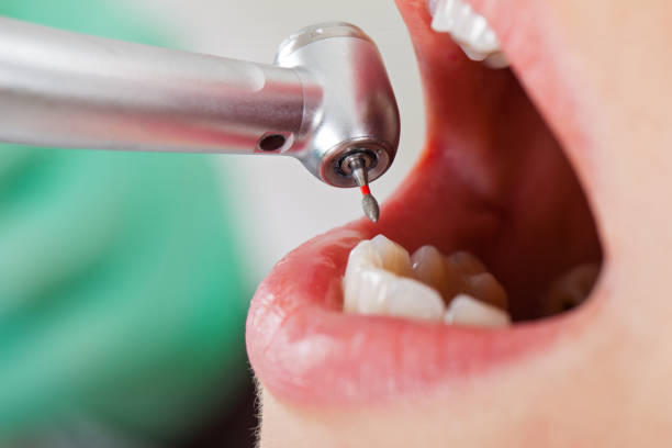 Best Emergency Dentist for Knocked-Out Tooth in Susitna North, AK